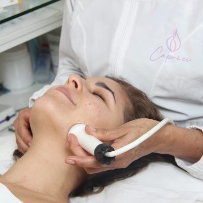 Dermapen -Microneedling 02